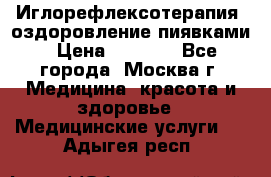 Иглорефлексотерапия, оздоровление пиявками › Цена ­ 3 000 - Все города, Москва г. Медицина, красота и здоровье » Медицинские услуги   . Адыгея респ.